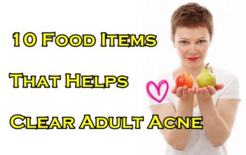 food-diet-acne