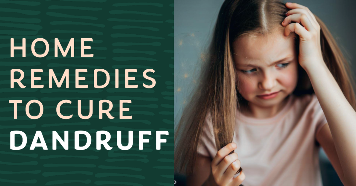 Home Remedies to Get Rid of Dandruff Naturally & Diet for Relief